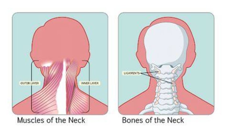 Can a draught cause a stiff neck?