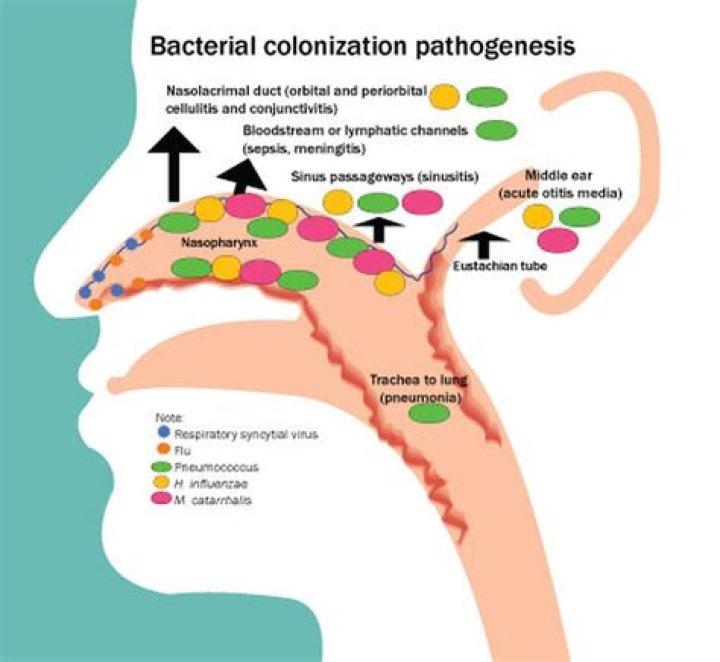 Can covid colonized in nares?