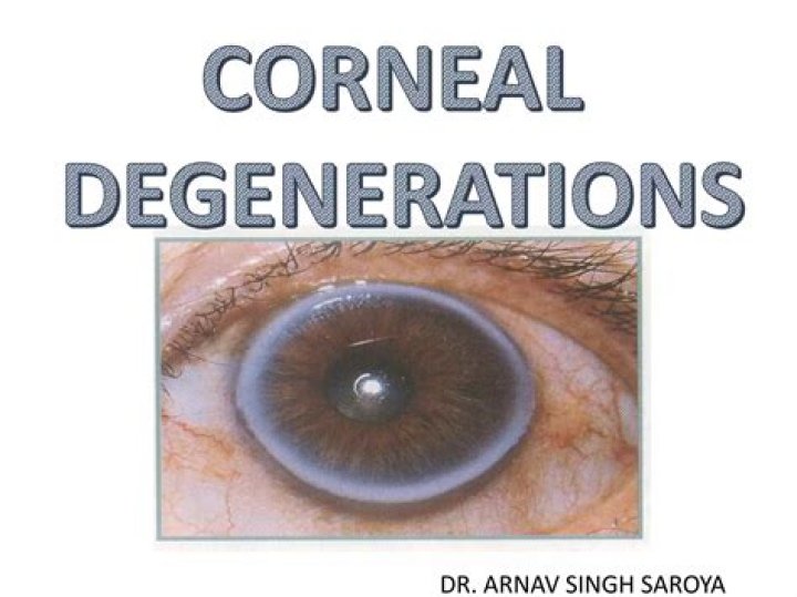 What are corneal degenerations?