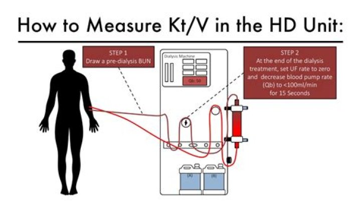 What is kt/v in dialysis?
